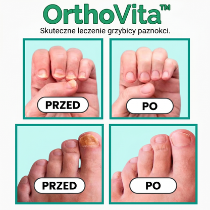 OrthoVita™